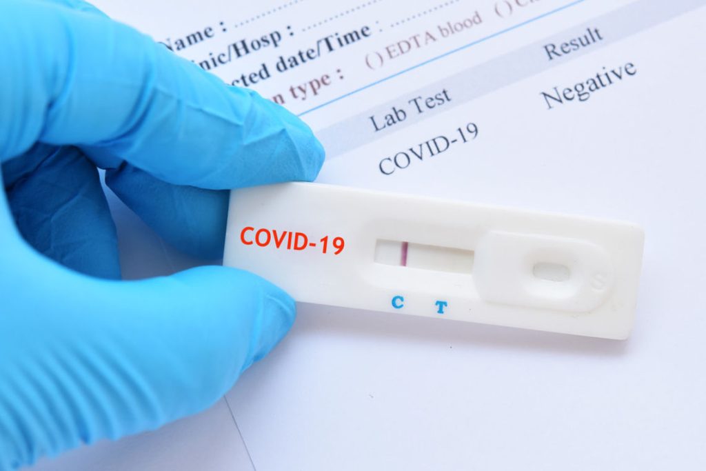 covid-19-ag-teste